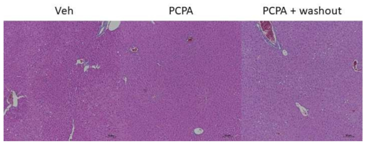 PCPA 투여 및 투여 중단 후의 간 H&E 염색사진