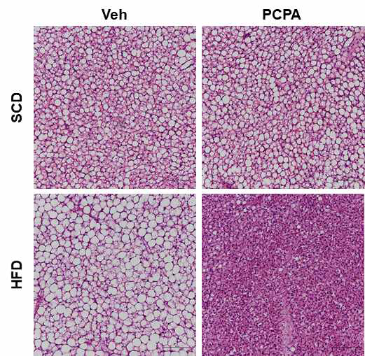 Thermoneutral(30℃) 환경에서 PCPA 투여 시의 갈색지방 H&E