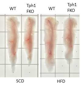 지방세포 특이적 Tph1 결손 마우스의 피하지방