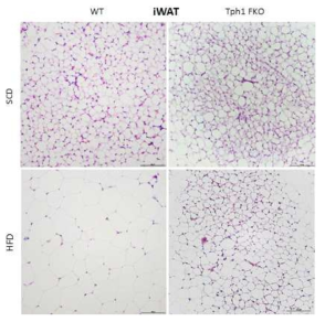 지방세포 특이적 Tph1 결손 마우스의 피하지방 H&E 염색사진