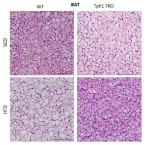 지방세포 특이적 Tph1 결손 마우스의 갈색 지방 H&E 염색사진