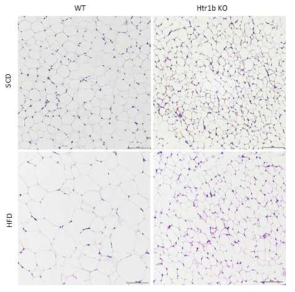 Htr1b KO 마우스의 피하지방의 H&E 염색사진