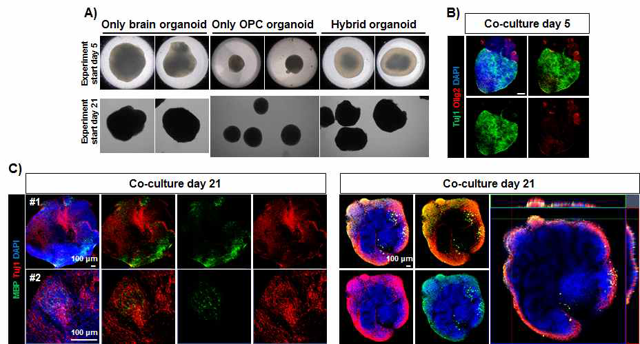 인간 역분화줄기세포 유래의 수초화 형성 하이브리드 뇌 오가노이드 제작 및 분석