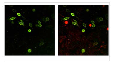 과발현되어 녹색 형광으로 표지된 Tie2와 적색으로 표지된 세포막