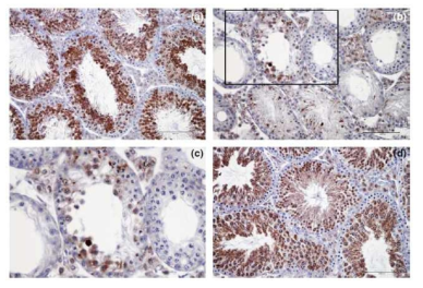 Protective effect of capsaicin against the phospholipid hydroperoxide glutathione peroxidase (PHGPx) immunostaining reduced by heat stress (HS) in mice testes. PHGPx immunoreactivity in the control group was mainly observed in round and elongated spermatids and spermatozoa and was weakly detected in interstitial Leydig cells (a). However, PHGPx immunoactivity in the testes exposed to HS was stained in seminiferous tubules with a severe loss of spermatogenic cells and interstitial Leydig cells (b and c). On the other hand, the attenuated immunoactivity of PHGPx induced by HS in the testes was recovered to almost normal by pre-treatment with capsaicin (d). (a) normal control group, (b) HS alone group, (c) enlarged picture of the rectangular area in b, (d) HS + Cap group. Lc: Leydig cell. Scale bar: 100 μm