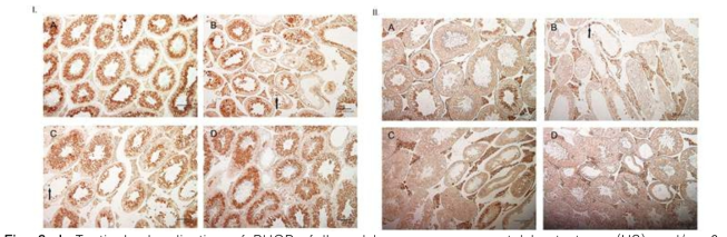 I. Testicular localization of PHGPx followed by exogenous scrotal heat stress (HS) and/or β-carotene (β-CA) or ellagic acid (EA) treatment. PHGPx immunoreactivity in the testes from the normal control group (A), HS group (B), HS plus EA group (C) and HS plus β-CA group (D). PHGPx was intensively detected in round and elongated spermatids in seminiferous tubules and weakly interstitial Leydig cells (A, D), but more strongly observed in multinucleated giant cells (arrows) and interstitial Leydig cells (B, C). II. Immunolocalization of MnSOD in testes followed by exogenous scrotal HS and/ or β-CA or EA treatment. MnSOD protein was observed in the testes from the normal control group (A), HS group (B), HS plus EA group (C) and HS plus β-CA group (D). While MnSOD immunoreactivity was mainly observed in elongated spermatids and interstitial Leydig cells in the normal control group and HS plus β-CA group (A, D), it was strongly detected in spermatogonia (arrow) and early spermatocytes, as well as Leydig cells in the HS group and HS plus EA group (B, C). Bar: 100 μm