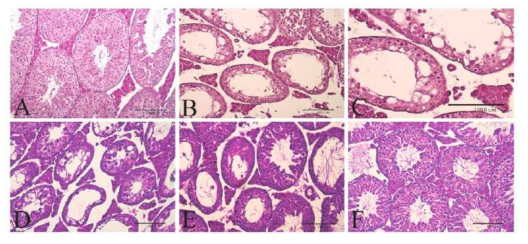 Representative histopathological findings of mouse testes subjected to heat stress (HS) with or without curcumin (20, 40, and 80 mg kg−1; D–F) administration. The control group showed normal testicular morphology and spermatogenesis (A). In the HS group, the arrangement of cells was disturbed in the seminiferous tubules, which were much smaller in diameter than in the normal control group. The epithelium with a large proportion of tubules showed signs of degeneration, vacuolization and disorganization. Additionally, disarray and desquamation of spermatogenic cells characterized the extent of HS injury (B and C). However, curcumin administration (D–F) to heat-treated groups induced a significant improvement in a dose-dependent manner relative to the HS group. H&E staining (bar: 100 μm)