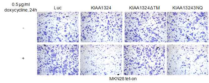 KIAA1324 단백질 발현에 따른 위암 세포주의 이동성 변화 조사