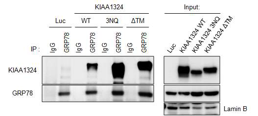 KIAA1324 글리코실화가 GRP78 단백질과의 결합에 미치는 영향 확인