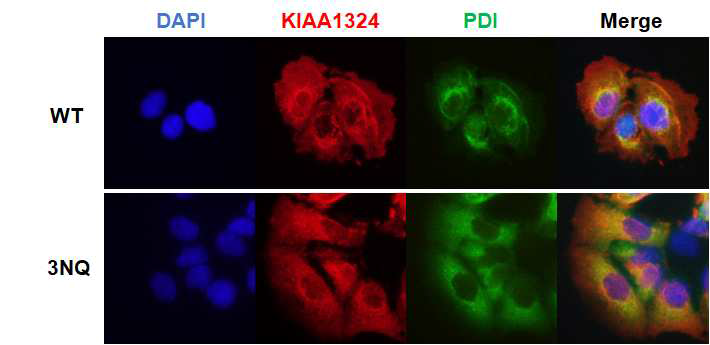 KIAA1324 정상체와 글리코실화 비활성 돌연변이체의 세포내 위치 확인