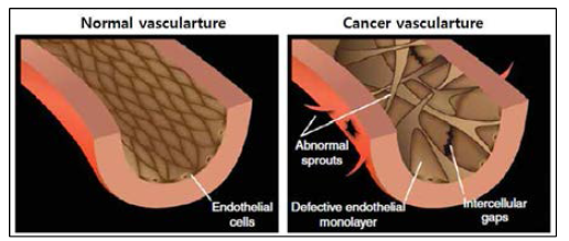 Abnormality of cancer endothelial cells