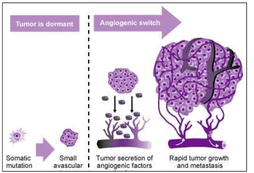 암조직의 신생혈관형성