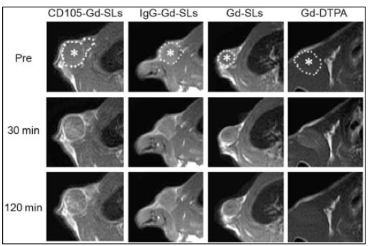 Gd로 라벨링된 anti-CD105-mAb를 이용한 CD105 발현의 MRI 이미징