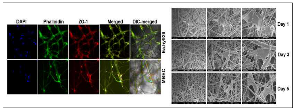 PCL 나노섬유에서 VEGF를 함유하는 배양액으로 배양한 혈관내피세포를 형광현미경으로 본 이미지 (좌측)와 전자현미경으로 본 사진 (우측)