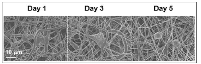 PCL 나노섬유에서 DMEM 배지로 배양한 BEND3 혈관내피세포주의 전자현미경 이미지