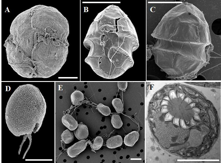 본 연구팀이 2차년도 연구기간 동안 분리, 배양에 성공한 신규 단종배양체들의 전자현미경 (SEM, TEM) 사진. (A) Takayama helix, (B) Heterocapsa minima, (C) Stoeckeria cf. algicida, (D) Rhodomonas abbreviata, (E, F) Dunaliella sp., Scale bars= 5 μm