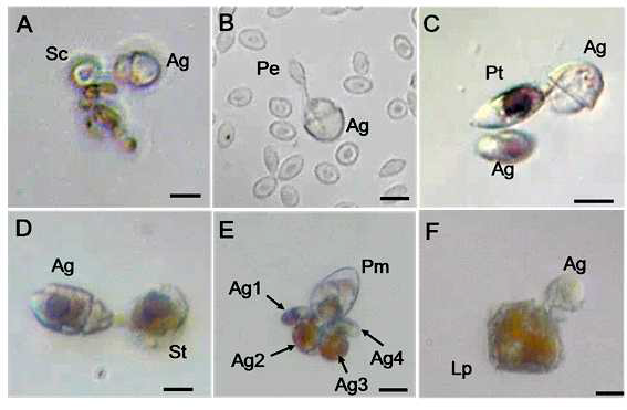 단종배양체 종속영양성 편모류 Aduncodinium glandula가 다양한 먹이 종류를 peduncle 기관을 사용하여 섭식하는 장면. (A) A. glandula on Skeletonema costatum (B) A. glandula on Perch blood cell (C) A. glandula on Prorocentrum triestinum (D) A. glandula on Scrippsiella trochoidea (E) A. glandula on Prorocentrum micans (F) A. glandula on Lingulodinium polyedrum. All Scale bar = 10 μm