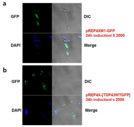 GFP와 TDP43-GFP fusion protein의 localization (a: GFP 발현 b: TDP-43WT 발현, DAPI: 핵 염색)