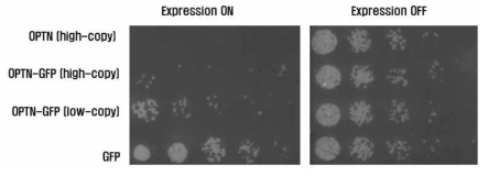OPTN 발현양이 많을수록 독성 증가