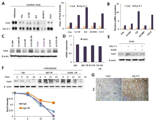 방사선 반응 분비인자 IL6에 의한 EMT 전사인자 Twist 단백질의 안정화