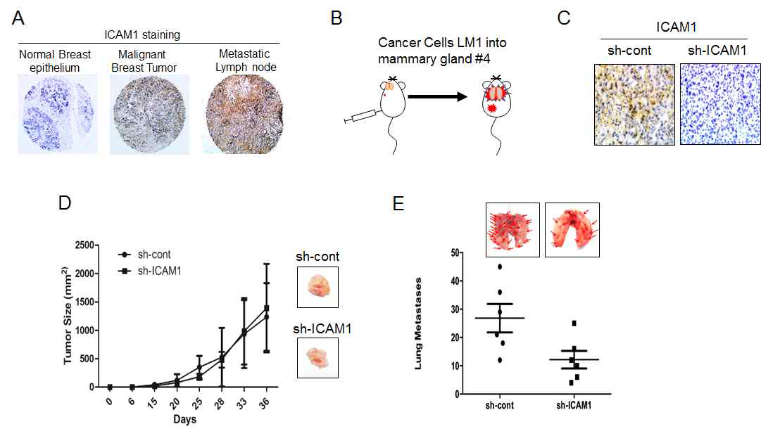 ICAM-1에 의한 유방암세포의 in vivo 전이능 획득