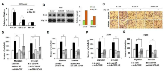 방사선 반응 분비인자 G-CSF에 의한 폐암세포의 이동성 및 침윤성 획득