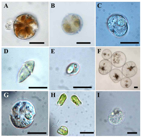 본 연구에서 1차년도 조사기간 동안 새롭게 분리 또는 배양에 성공한 단종배양체의 광학현미경 (LM) 사진. (A) Alexandrium andersonii, (B) Alexandrium sp., (C) Gryptoperidiniopsis sp., (D) Gyrodinium sp., (E) Katablepharis japonica, (F) Noctiluca scintillans, (G) Peridiniella danica, (H) Pyramimonas disomata, (I) Unidentified naked ciliate (10 μm-size), Scale bars= 10 μm for (A-E, G-I), and 100 μm for F