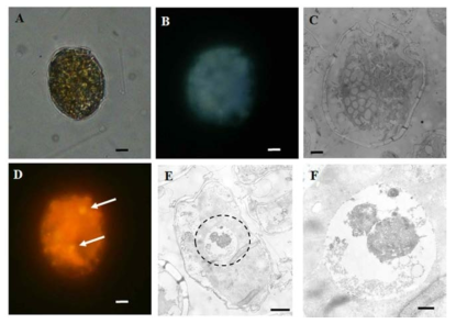 혼합영양성 와편모류 Thecadinium kofoidii. (A) 먹이를 섭식하는 않은 T. kofoidii 광학현미경, (B) 형광현미경, (C) 투과전자현미경 (TEM) 사진. (D) T. kofoidii가 광영양 세균을 섭식한 형광현미경사진. (E & F) T. kofoidii가 저서 은편모류인 Rhodomonas salina을 섭식한 TEM사진