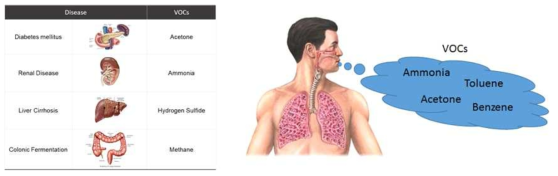 질병에 따라 환자의 날숨에 포함된 내인성 유기화합물