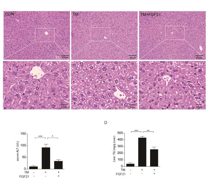 Tunicamycin에 의한 비알콜성간질환은 FGF21의 과발현으로 간손상회복됨 Tunicamycin (TM)