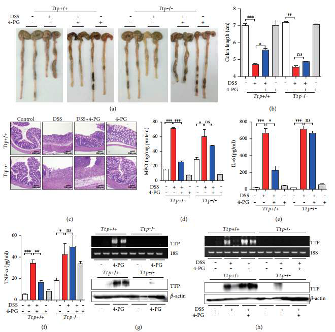 TTP deficiency abolished the anti-inflammatory effect of 4-PG in a DSS-induced colitis model. To construct an acute colitis animal model, 10 weeks Ttp+/+ and Ttp−/− mice were administrated with 3% DSS dissolved in drinking water for 7 days in the presence or absence of 4-PG (10 mg/kg, i.p. injection). Then, the mice from 4-PG and DSS+ 4-PG groups were still administrated with 4-PG (10 mg/kg, i.p. injection) for another 3 days. After 10 days’ treatment, the mice were sacrificed, and the entire colon was removed from the cecum to the anus. (a) Representative images of 6 tests conducted in each group. (b) Bar graph represents the colon length from each group. (c) Colon tissues were excised, and representative colon histology was shown by hematoxylin and eosin staining. (d) Neutrophil infiltration into the colon was measured by the expression of myeloperoxide (MPO) in colon tissues. The protein level of proinflammatory cytokines, IL-6 (e) and TNF-α (f), were detected by ELISA kit from serum. (g, h) The mRNA and protein levels of TTP in colon tissues from Ttp+/+ and Ttp−/− mice were detected by RT-PCR and Western blot. 18S RNA and β-actin were used as internal controls. Data are expressed as means ± SE, n = 6. ∗P < 0 05, ∗∗P < 0 01, ∗∗∗P < 0 001. ns: not significant