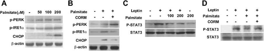 CO reverses palmitate-induced leptin resistance in SK-N-AS-Ob-Rb cells. SK-N-AS-Ob-Rb cells were incubated with palmitate at indicated concentrations for 6 h (A), or preincubated with CORM-2 (20 μM) for 2 h (B), and then treated with palmitate (200 μM, 6 h), and expression levels of p-PERK, p-IRE1α, and CHOP were analyzed by Western blotting. C: SK-N-AS-Ob-Rb cells were preincubated with palmitate at the indicated concentrations for 6 h, and then treated with leptin (10 μg/ml) for 15 min. Cell lysates were subjected to Western blotting analysis for p-STAT3 and STAT3 expression. D: SK-N-AS-Ob-Rb cells were preincubated with CORM-2 (20 μM) for 2 h and then treated with palmitate (200 μM/ml, 6 h) and then stimulated with eptin (10 μ g/ml) for 15 min. p-STAT3 and STAT3 levels were analyzed by Western blotting