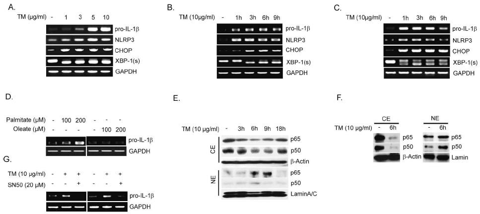 ER stress induces the expression of pro-IL1b mRNA via the activation of NF-kB. primary peritoneal macrophages (A-B) and Raw264.7 cells (C) were treated with TM and then mRNA expression for pro-IL-1b, NLRP3, CHOP, and XBP-1(s) were determined by PCR. (D) Raw264.7 cells were treated with the saturated fatty acids such as palmitate (C16:0) or equivalent monounsaturated fatty acids (oleate, C18:1) for 6h at the indicated concentration and mRNA expression for pro-IL-1b was determined by RT-PCR. (E) U937 leukemia cells were treated with TM (10 mg/ml), and then the level of RelB/p65 and p50 in cytosolic(upperpanel) and nuclear(lowerpanel) extracts was determined by Western immunoblotanalysis .b-actin was served as the standard. Lamin A/C was served as the standard for nuclear extracts. (F) Peritoneal macrophages were treated with TM (10 mg/ml) for 6 hrs. The expression of RelB/p65 and p50 subunits of NF-kB was determined in cytosolic and nuclear extracts. b-actin was served as the standard. Lamin A/C was served as the standard for nuclear extracts. (G) U937 (leftpanel) and THP-1 leukemia cells(rightpanel) were treated with TM (10 mg/ml) in the absence or presence of the NF-kB translocation inhibitor SN50 (20 mM). The expression of pro-IL-1b mRNA was determined by RT-PCR. GAPDH or 18s rRNA was served as the standard. Blots shown are representative of three independent experiments