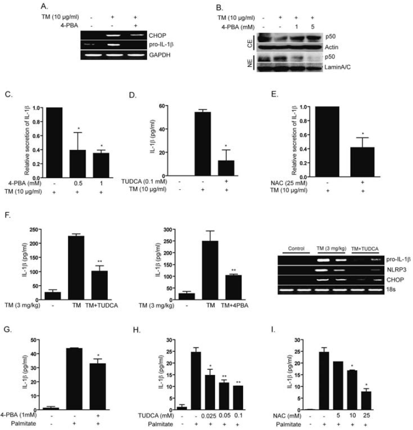 Chemical chaperone treatment attenuates ER stress-mediated IL-1b production. U937 cells (A-C) were treated with TM (10 mg/ml) for 18 hrs, in the absence or presence of 4-PBA (0.5 mM). (A) The level of pro-IL-1b and CHOP mRNA was analyzed by PCR. GAPDH served as the standard. (B) The nuclear translocation of the p50 subunit of NF-kB was determined by Western immunoblot analysis. b-actin was served as the standard. Lamin A/C was served as the standard for nuclear extracts. (C) IL-1b secretion in U937 supernatants was determined by ELISA. (D-E) U937 cells were treated with TM (10 mg/ml) for 18 hrs, in the absence or presence of TUDCA (0.1 mM) or NAC (25 mM). IL-1b secretion in U937 supernatants was determined by ELISA. (F) C57BL/6 mice were pre-injected with TUDCA (N=10, 500 mg/kg/day, i.p.), or pre-treated with 4-PBA (N=10,1gram/kg/dayoralgavage) for 20days. Attheend of the 20day pre-treatment, mice were injected 20days later with TM(3mg/kg,i.p.). Mice were sacrificed at 6h, post-injection and then blood was collected for the analysis of serum IL-1b (left and center panels). Liver tissue was collected for the analysis of pro-IL-1b, NLRP3, and CHOP mRNA expression levels in the liver by RT-PCR. 18s RNA was served as the standard (Figure 4F, rightpanel). U937 cells were pre-treated for 1 hr with (G) 4-PBA (1 mM), (H) TUDCA, or for 5 min with NAC (I) (at the indicated concentrations), and then treated with palmitate (200 mM) for 18 hrs. IL-1b secretion in U937 supernatants was determined by ELISA. Data represent mean +/- S.D of three independent determinations. *P<0.05,**P<0.01.Blots shown are representative of three independent experiments