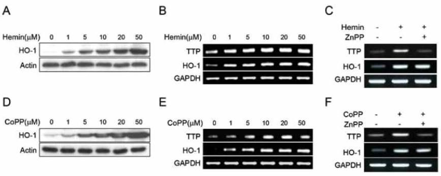 Induction of HO-1 increases TTP levels in macrophages. (A&B) RAW264.7cells were treated with the indicated concent ration of hemin for 18h. HO-1 levels were an analyzed by Western blot(A) and semi-qRT-PCR(B) and TTP levels were analyzed by semi-qRT-PCR (B). (C) RAW 264.7cells were pretreated with 20μM ZnPP for 30min and further incubated with 10μM hemin for 18h. The levels of TTP and HO-1 were analyzed by semi-qRT-PCR. (D&E) RAW 264.7cells were treated with theindicated concent ration of CoPP for 18h. HO-1 levels were analyzed by Westernblot (D) and semi-qRT-PCR (E) and TTP levels were analyzed by semi-qRT-PCR (E). (F) RAW 264.7cells were pretreated with 20μM ZnPP for 30min and further incubated with 10μM CoPP for 18h. The levels of TTP and HO-1 were analyzed by semi-qRT-PCR