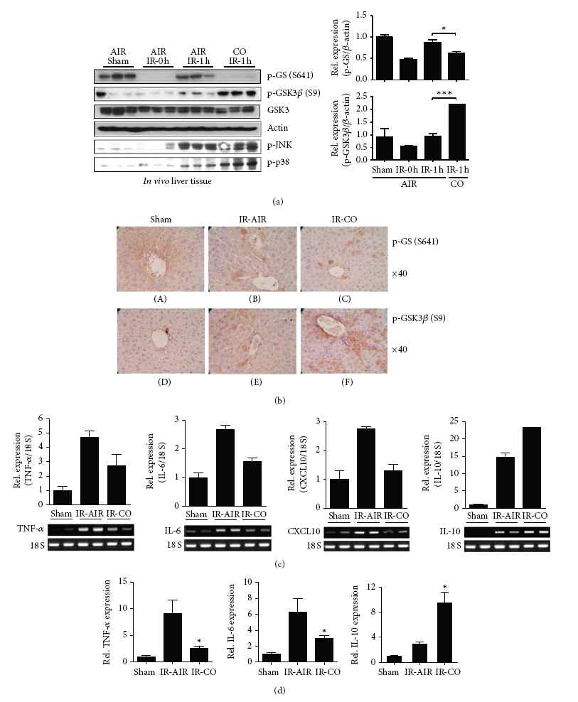 Inhibition of GSK3β by CO inhalation ameliorates liver I/R injury. Mice were sham-operated or subjected to 90 minutes hepatic warm ischemia followed by 1 hour reperfusion. Recipients were treated with air or CO gas (250 ppm) inhalation. (a) Liver samples, harvested 1 hour later, were subjected to Western blot analysis of phospho (p)-GS (GS 641), p-GSK3β (S9), p-JNK, and p-p38. β-Actin was used as an internal control. ∗<0.05, ∗∗∗<0.001. (b) Immunohistochemical staining of GSK3 inhibition. Mice were sacrificed, liver tissues were harvested, and the tissue slices were processed for formalin-fixed paraffin embedding. Hematoxylin counterstaining after 3-amino-9-ethylcarbazole-based immunohistochemical staining was used to detect GS 641 ((A)–(C), red/brown) and phosphorylation of GSK3β S9 ((D)–(F), red/brown). ((c) and (d)) Quantitative RT-PCR-assisted detection of TNF-α, IL-6, CXCL10, and IL-10 gene expression at 1 hour or 6 hours in liver tissue. Data were normalized to 18S gene expression. Data shown represent the mean ± S.D. (=4-5/group), ∗< 0.05