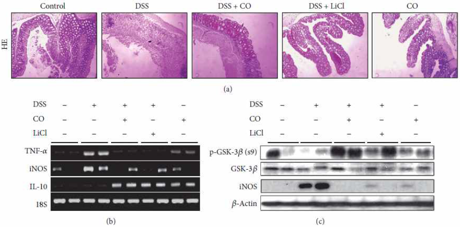 COattenuates experimental colitis asmeasuredbyhistology incolonand inflammatory cytokines in colon.Mice were administrated with 3% DSS with drinking water for 6 days and CO (250 ppm) inhalation for 4 h daily and injection of LiCl (200mg/kg, i.p) was performed daily for more 4 days. (a) ColonsectionsweresubjectedtoH&Estaining.(b)TNF-α,iNOS,andIL-10mRNAlevelswere detected from colon tissue by RT-PCR. (c) iNOS and pGSK-3β protein levels were measured from colon tissue by western blotting