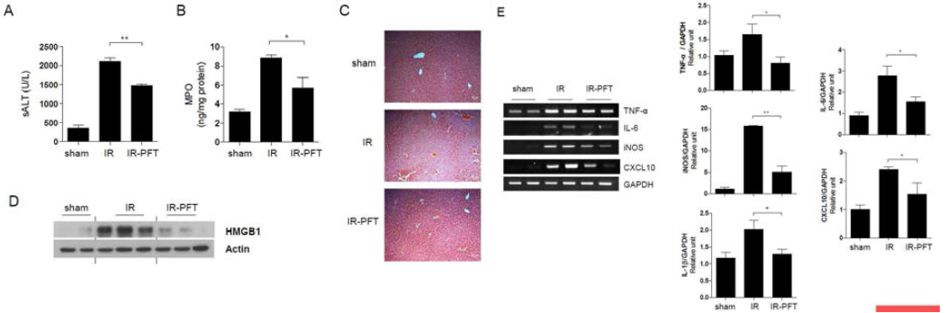 P53 inhibitor, PFT administration ameliorates liver I/R injury in mice. Mice were subjected to 60 minutes liver warm ischemia, followed by 4 h reperfusion. Liver samples were harvested from unclamped mice (sham) or mice clamped and pretreated with DMSO (IR), Pifithrim-α (IR-PFT). (A) Hepatocellular function was evaluated by sALT (U/L). (B) MPO level, an index of neutrophil infiltration. (C) H&E staining of liver sections from each group. (D) Hepatic HMGB1 expression in liver tissue was assessed by western blot analysis. (E) Semi- and quantitative RT-PCR-assisted detection of TNF-α, IL-6, iNOS, CXCL10, and IL-1β gene expression in liver samples. Data were normalized to GAPDH gene expression. Data represent the mean ± SEM (N=4-6 samples/group). *P<0.05,**P<0.01