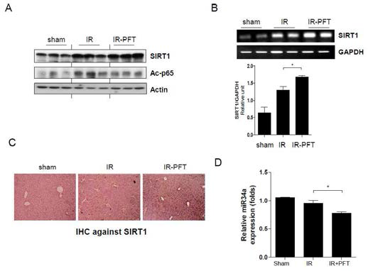 PFT induces SIRT1 expression after hepatic ischemia/reperfusion (I/R). Liver samples were harvested at 4 hours after liver IRI. (A) Hepatic expression of SIRT1 and Ac-p65 were evaluated in IR lobes from DMSO (IR) and PFT (PFT-IR) injected mice versus sham mice by immunoblotting. (B) SIRT1 mRNA expression, as detected by semi- and quantitative RT-PCR in liver tissue. Data were normalized to GAPDH mRNA levels. (C) Immunohistochemical staining of SIRT1. (D) Expression of miR34a was evaluated in liver tissue by quantitative RT-PCR. Data were normalized to RNU6B. Data shown represent the mean ± SEM. (N=4-6/group), *P<0.05