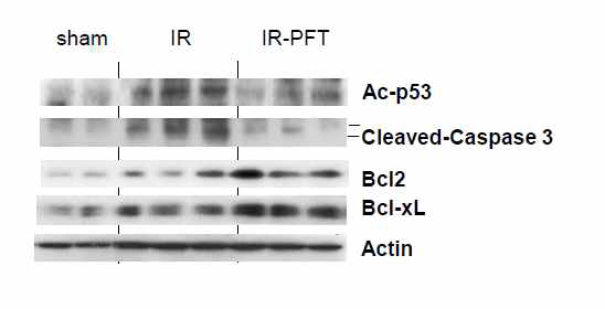 PFT increases SIRT1 induction, promotes anti-apoptotic functions. Hepatic expression of acetylated p53, cleaved caspase 3, Bcl2, Bcl-xL and actin were evaluated in IR lobes from DMSO (IR) and PFT (PFT-IR) injected mice versus sham mice by immunoblotting