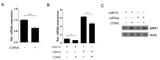 CO decreases miR34a expression and increases SIRT1 expression. (A and B) AML12 hepatocytes were transfected with miR34a mimic for 36 hours. Cells were pretreated with CORM2. After 6h, luciferase activity was measured. Expression of miR34a was evaluated by quantitative RT-PCR. Data were normalized to RNU6B. (C) Cell lysates were analyzed by western blotting with Abs against SIRT1 and β-actin