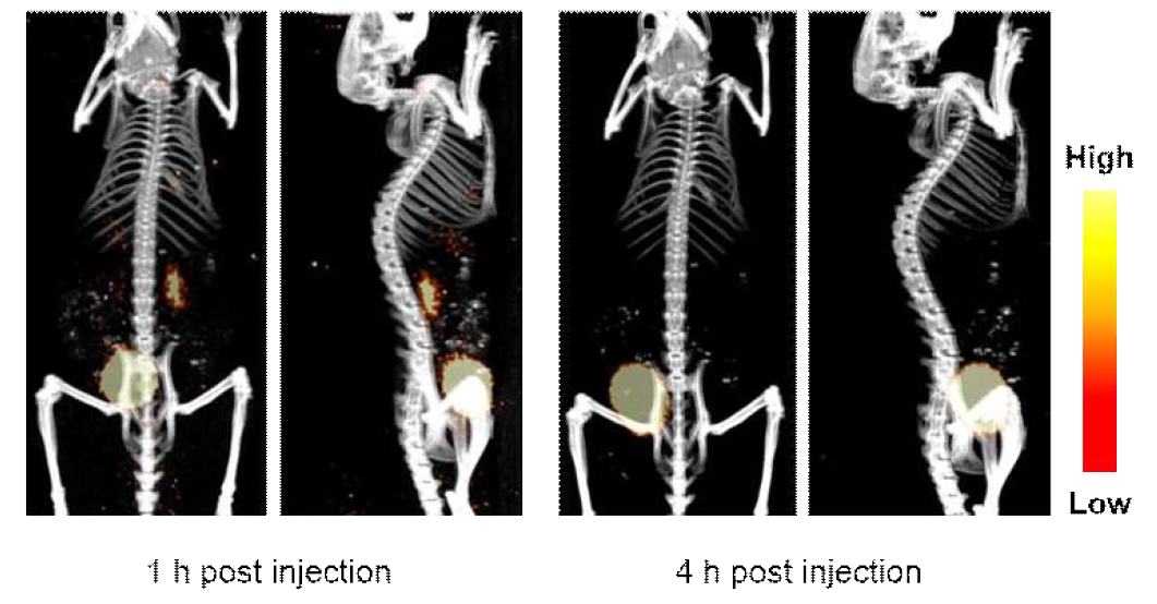 [125I]1B의 whole body SPECT/CT 영상