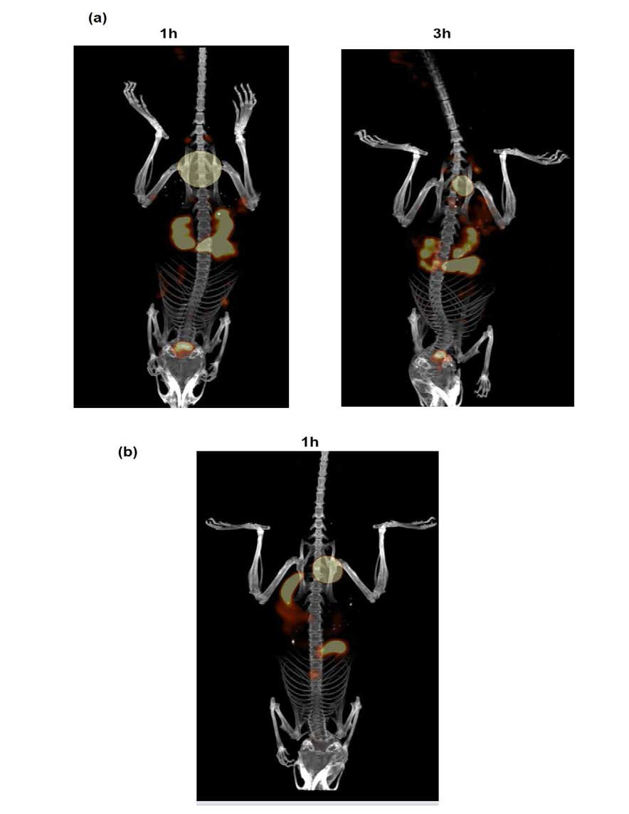 SPECT images of 99mTc labeled IL-6peptide(G3IL6P2) I.V injection in the mouse at 1 and 3 hr after I.v. administration that is suffering Acute pancreatitis(a) with normal control mouse(b)