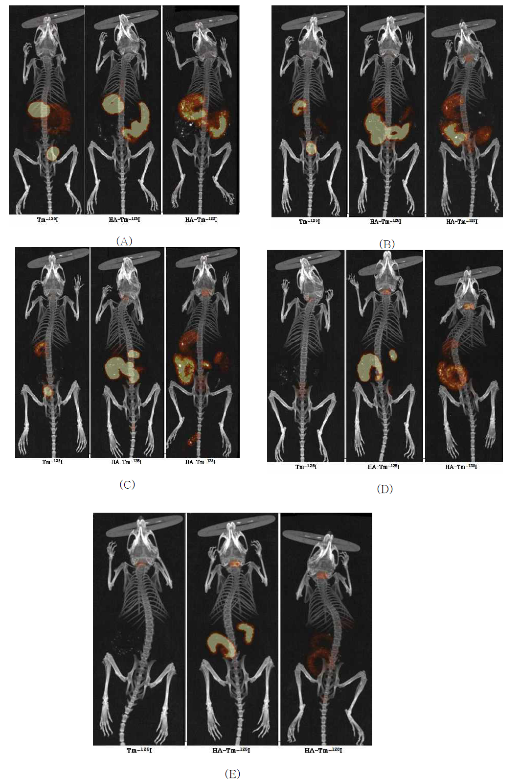 Tm-125I, HA-Tm-125I 및 HA-Tm-123I을 경구투여 후 ¼(A), 3(B), 6(C), 12(D), 24(E) 시간 후 체내 영상