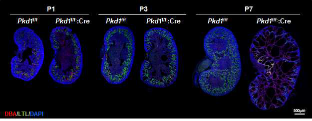 Pkd1 조건마우스의 표현형을 관찰하기 위한 시기별(생후 1일, 3일, 7일) 샘플링 및 신장튜블 마커 염색