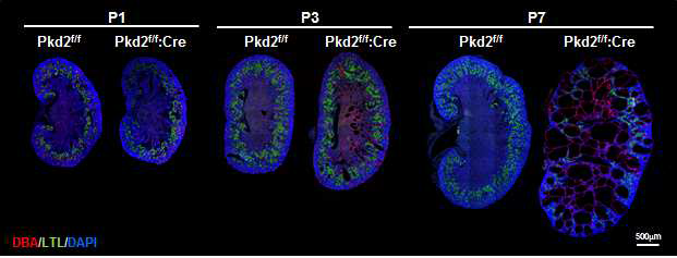 Pkd2 조건마우스의 표현형을 관찰하기 위한 시기별(생후 1일, 3일, 7일) 샘플링 및 신장튜블 마커 염색