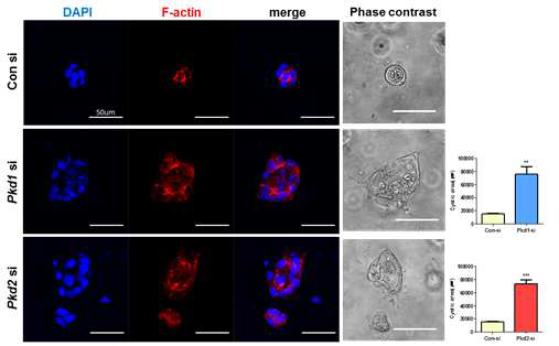 3D culture를 통해 Pkd1,2 의 유전자 발현의 감소를 통해 촉진되는 낭포형성과 F-actin의 구조 변화 관찰