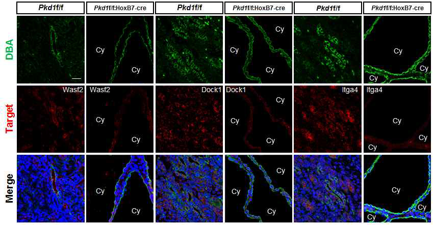Pkd1 cKO 마우스 모델에서의 Dock1, Wasf2 단백질 발현 검증