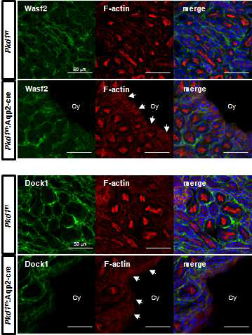 Pkd1 cKO 마우스 모델 조직에서 miR-182-5p 타겟 유전자인 Wasf2, Dock1의 단백질 발현량 검증과 F-actin 구조 확인