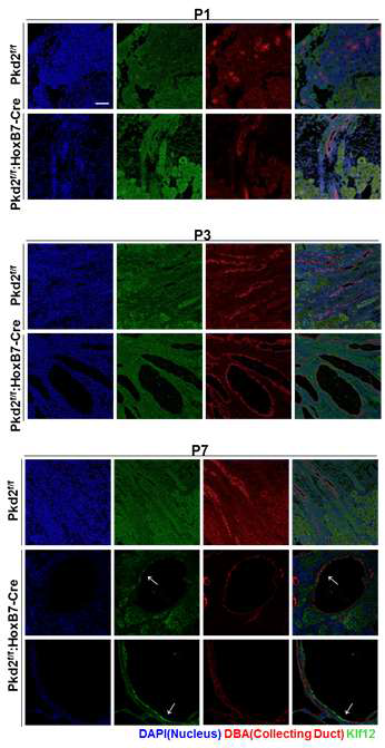 조직 염색을 통해서 확인한 시기별 Klf12 타겟 단백질의 발현 변화